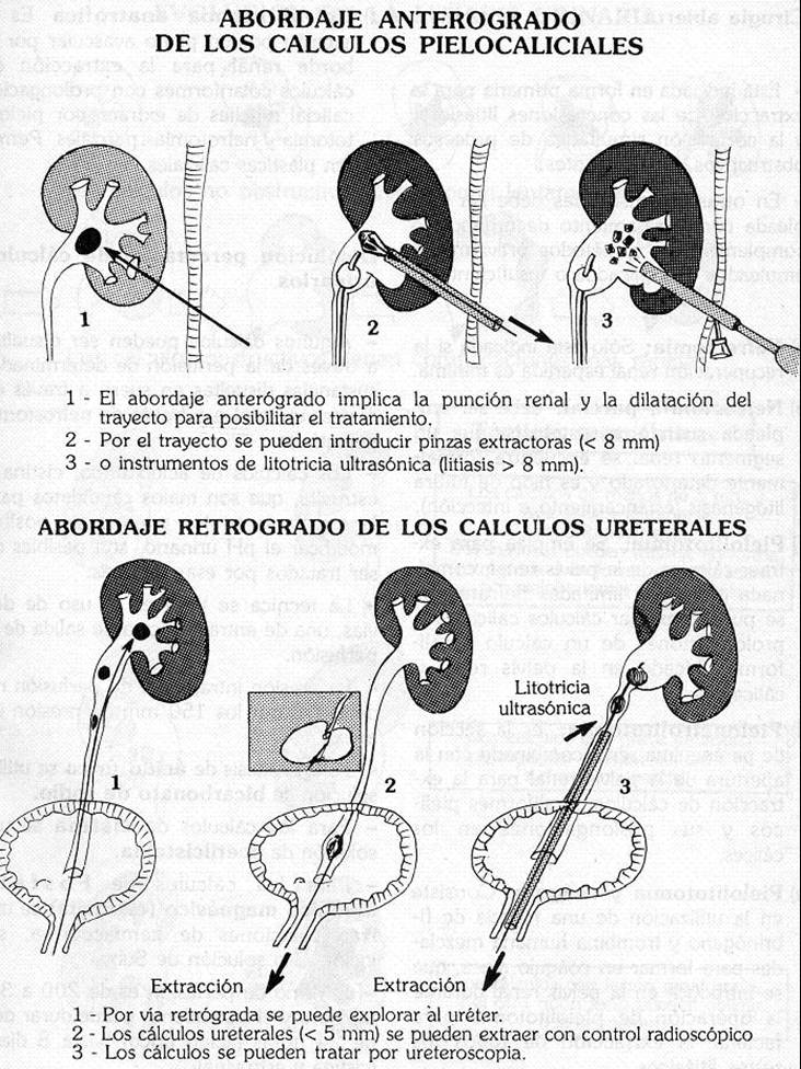 abordaje