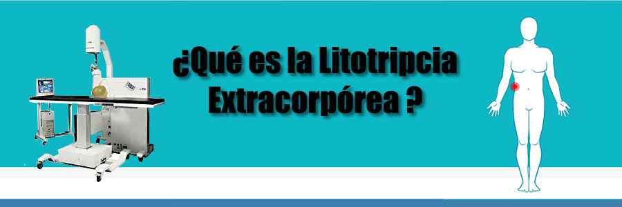 ¿Qué es la Litotripcia Extracorpórea?